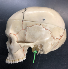 <p>"gummy hole" where jaw connects on models</p>