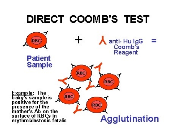 <p>Coombs test</p>