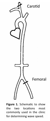<p>instrument for the measurement of the foot-to-foot wave speed.</p>
