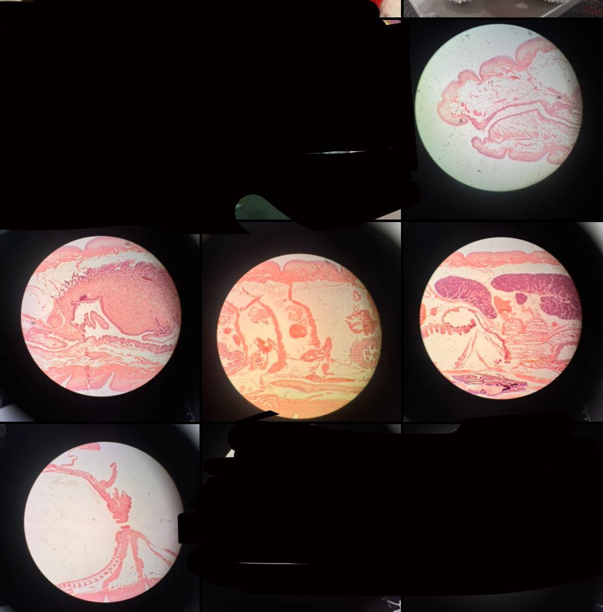 <p>Cross section of earthworm</p>