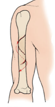 <p>A type of fracture that occurs when a twisting force is applied to the bone, resulting in a ragged break that encircles the bone. </p>