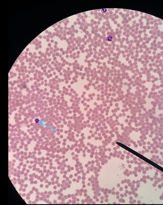 <p>ID cell</p>