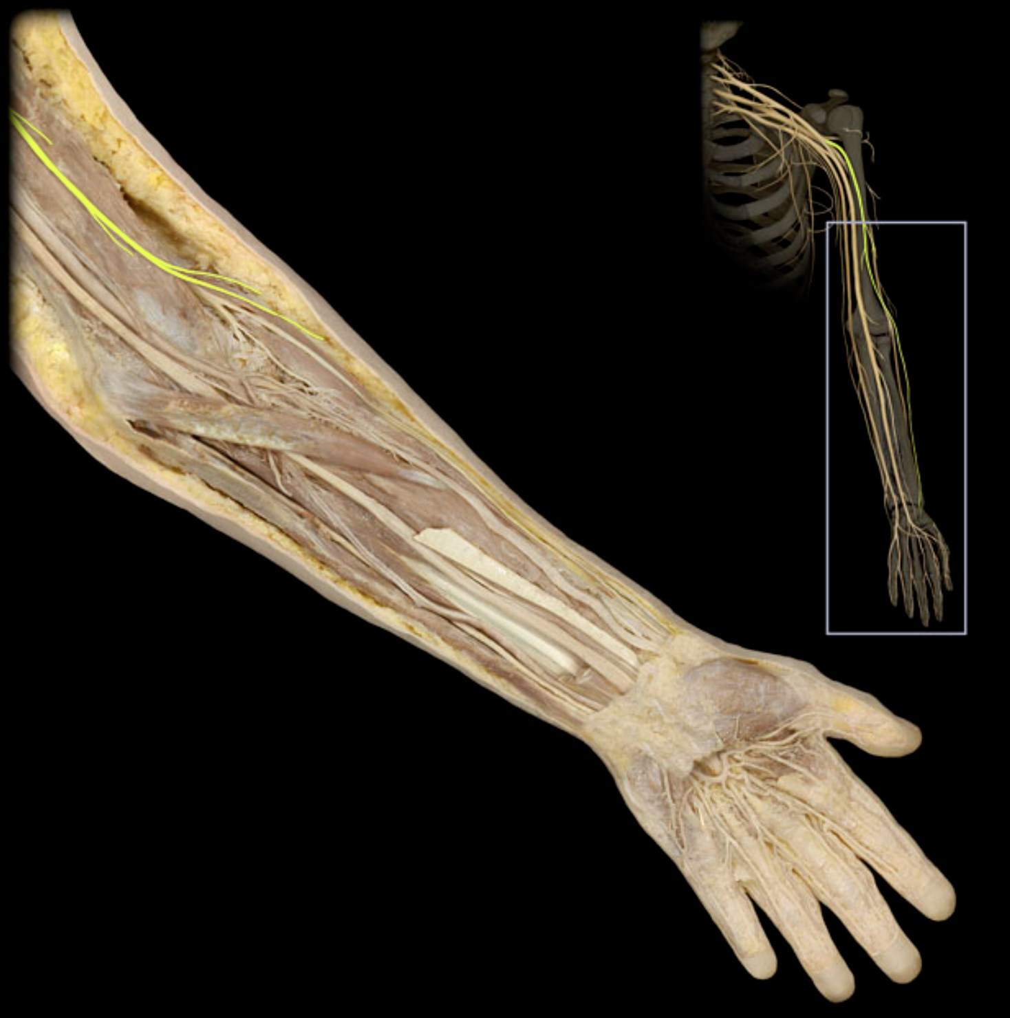 <p>What nerve is highlighted in yellow?</p>