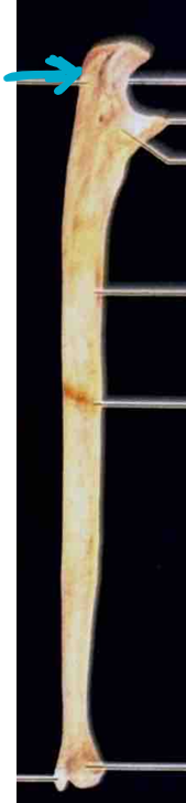 <p>ID ulna region </p>