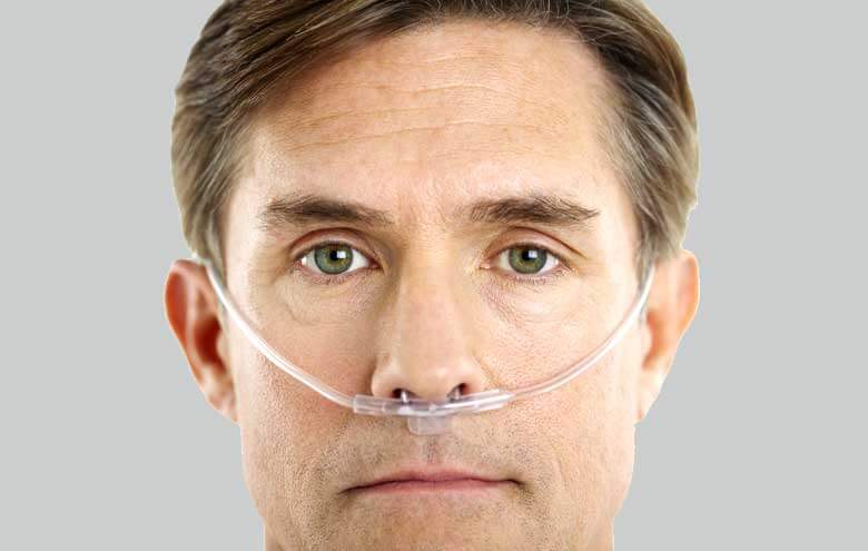 <ul><li><p>Piece of plastic tubing that fits around face and has two short prongs that fit inside the nose</p></li><li><p>Delivers oxygen through tubes</p></li></ul><p></p>