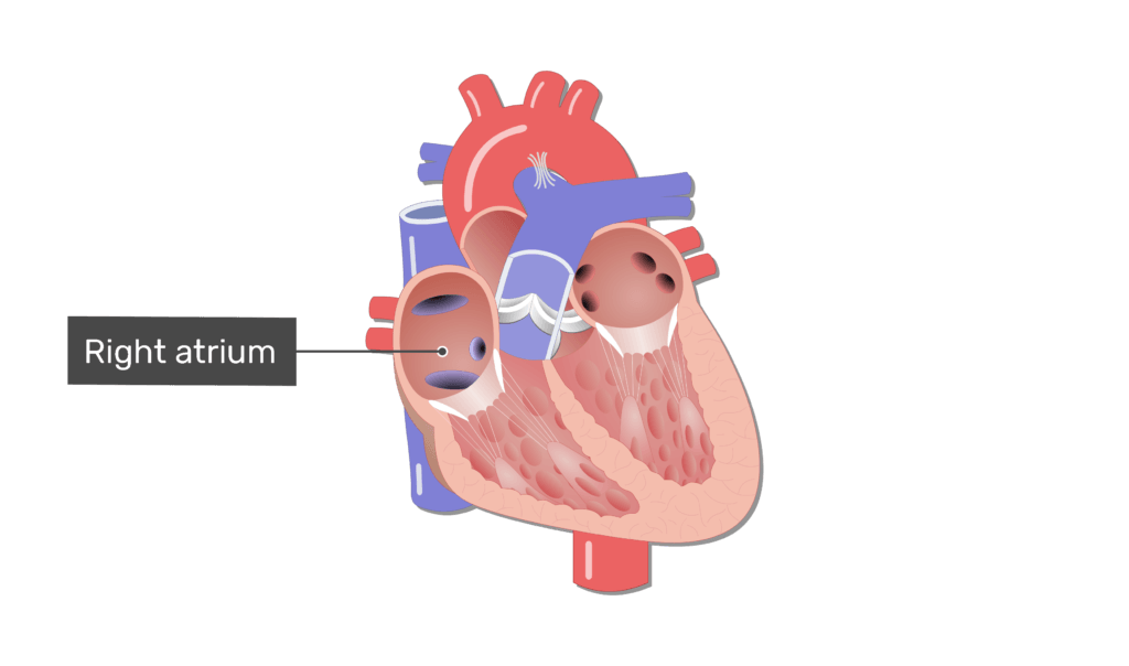 <ul><li><p><span style="background-color: transparent;">Receives blood from:</span></p><ul><li><p><span style="background-color: transparent;">Superior vena cava</span></p></li><li><p><span style="background-color: transparent;">Inferior vena cava</span></p></li><li><p><span style="background-color: transparent;">Coronary sinus</span></p></li></ul></li></ul><p></p><p>Has:</p><ul><li><p><span style="background-color: transparent;">Separated by the<strong> interatrial septum</strong></span></p></li><li><p><span style="background-color: transparent;">Separated from the right ventricle by the<strong> tricuspid (right atrioventricular) valve&nbsp;</strong></span></p></li><li><p><span style="background-color: transparent;"><strong>Right auricale </strong>slightly increases the capacity of the right atrium&nbsp;</span></p></li><li><p><span style="background-color: transparent;"><strong>Fossa ovalis </strong>- remanant of foramen volae (between left and right atria), which closes after birth&nbsp;</span></p></li><li><p><span style="background-color: transparent;"><strong>Foramen ovale</strong> is present in the fetus - blood bypasses fetal lungs</span></p></li></ul><p><br></p>
