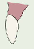 <p>what is the recommended location, advantages, disadvantages, indications, contraindications, and possible materials for a modified ovate pontic?</p>