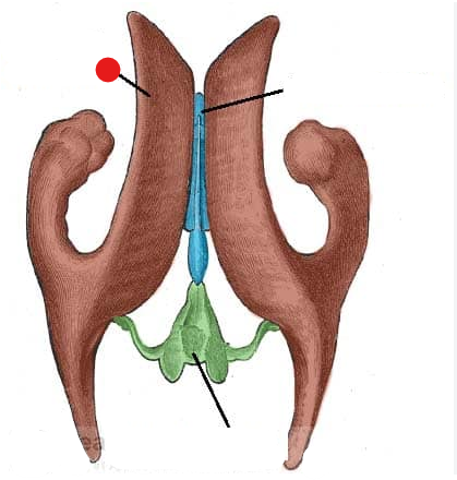<p>Identify the structure pinned</p>