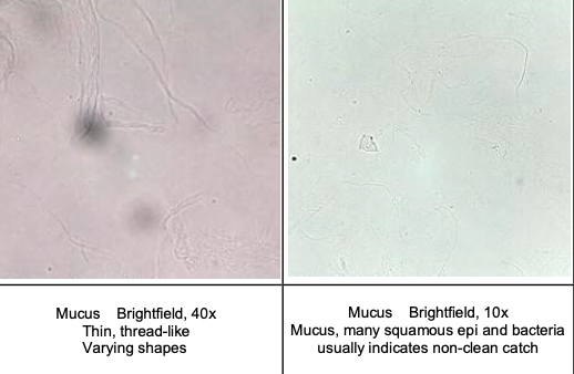 <p>Mucus</p>