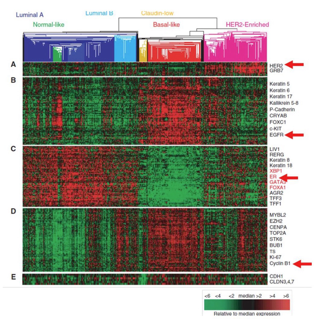 <p>Cancer is a disease of the <strong>genome</strong>; Knowing which <strong>genes</strong> are altered in a tumor cell allows personalized treatment of a patient’s disease</p><p>Important diagnostic and therapeutic tools for cancer are:</p><ul><li><p><strong>Tumor profiling</strong>: Sample levels of expression of key cancer-related genes</p></li><li><p>High throughput DNA sequencing of tumors</p></li></ul><p>While two patients may have the same diagnosis (i.e. breast cancer), there are often different underlying genetic variations</p><p>The study of the expression of proto-oncogenes lets us categorize cancers based on common genetic mutation; Helps inform the treatments for these </p><p>Green is good: Normal expression</p><p>Red is bad: Abnormal expression</p>