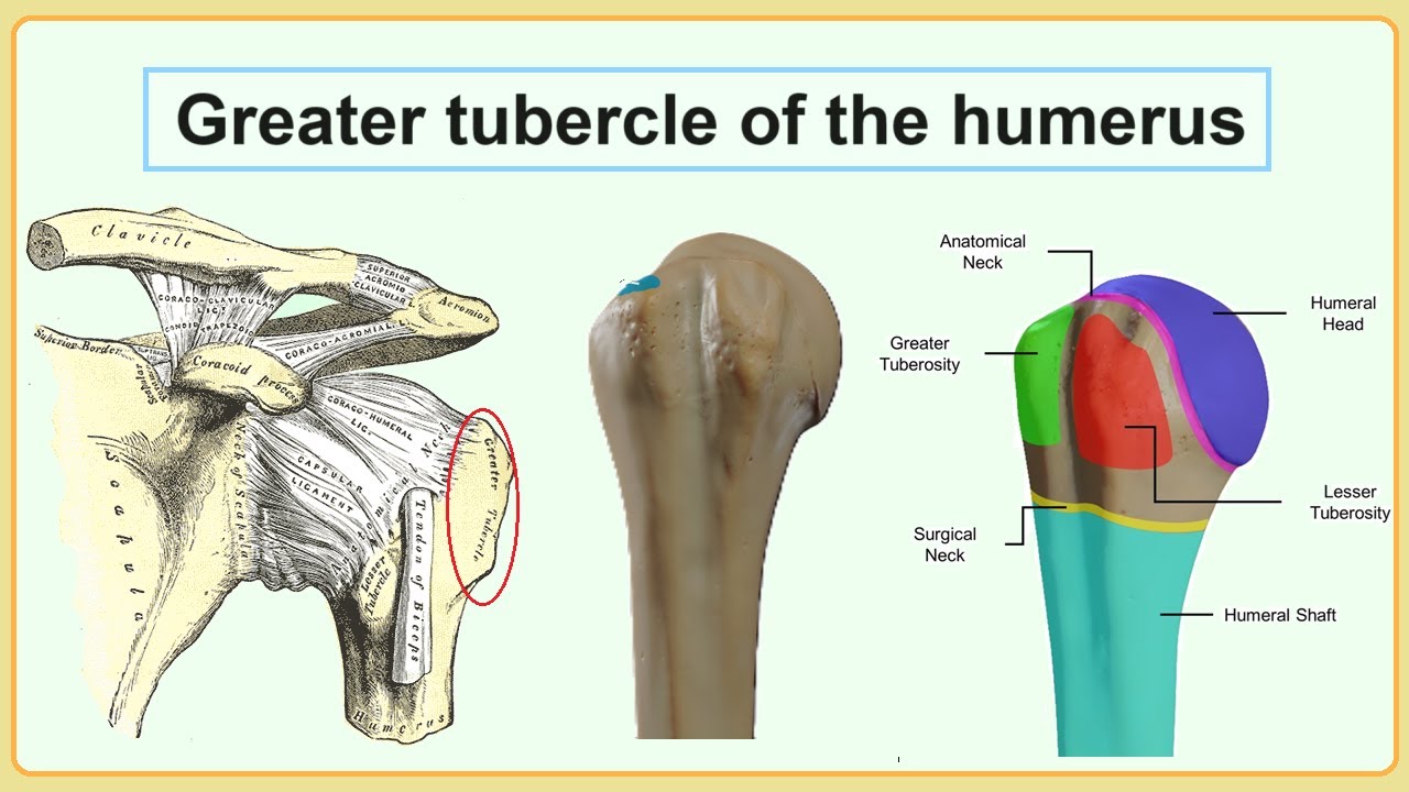 <p>Tubercle</p>