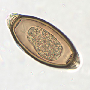 <p>Trichuris trichiura Life Cycle </p>