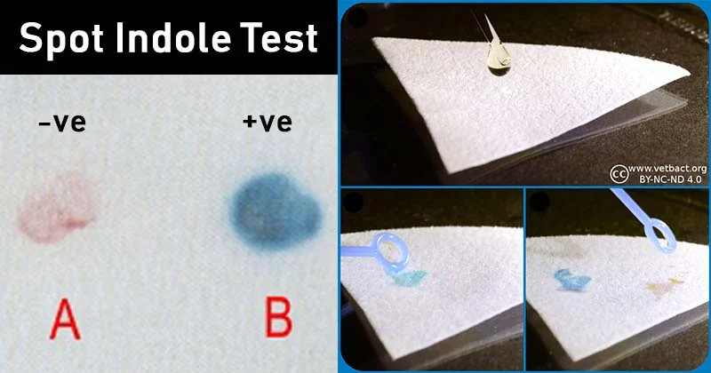 <ul><li><p>detects if an organism has the enzyme <u>tryptophanase</u></p><ul><li><p>breaks down tryptophan when bacteria are grown on SBA or chocolate agar</p></li></ul></li><li><p>a colony is smeared onto filter paper and Kovach’s reagent is added</p><ul><li><p><strong>positive reactions are blue-violet</strong></p></li></ul></li><li><p>differentiates <em>E. coli</em> (indole pos) from other <em>Enterobacteriaceae</em>, and <em>Proteus mirabilis </em>(indole neg) from <em>Proteus vulgaris</em> (pos)</p></li></ul><p></p>