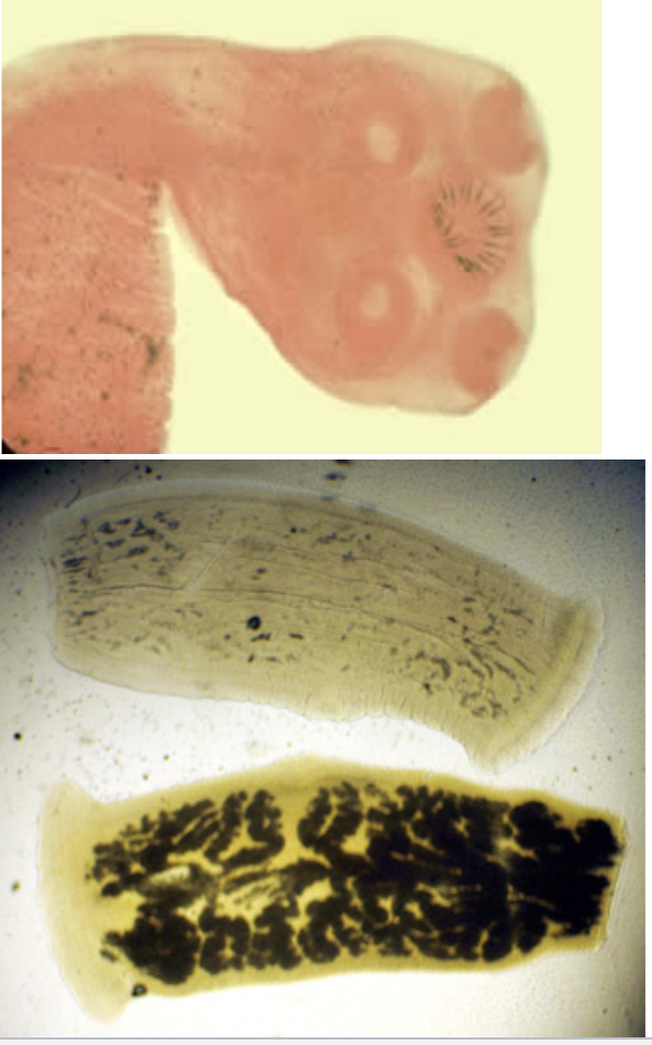 <p>-Scolex with four suckers with armed rostellum</p><p>-Proglottids</p><ul><li><p>Longer than they are wide</p></li><li><p><13 uterine branches</p></li></ul><p></p>