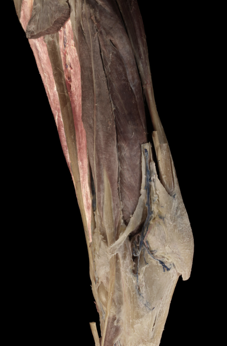 <p>which muscle is this</p>