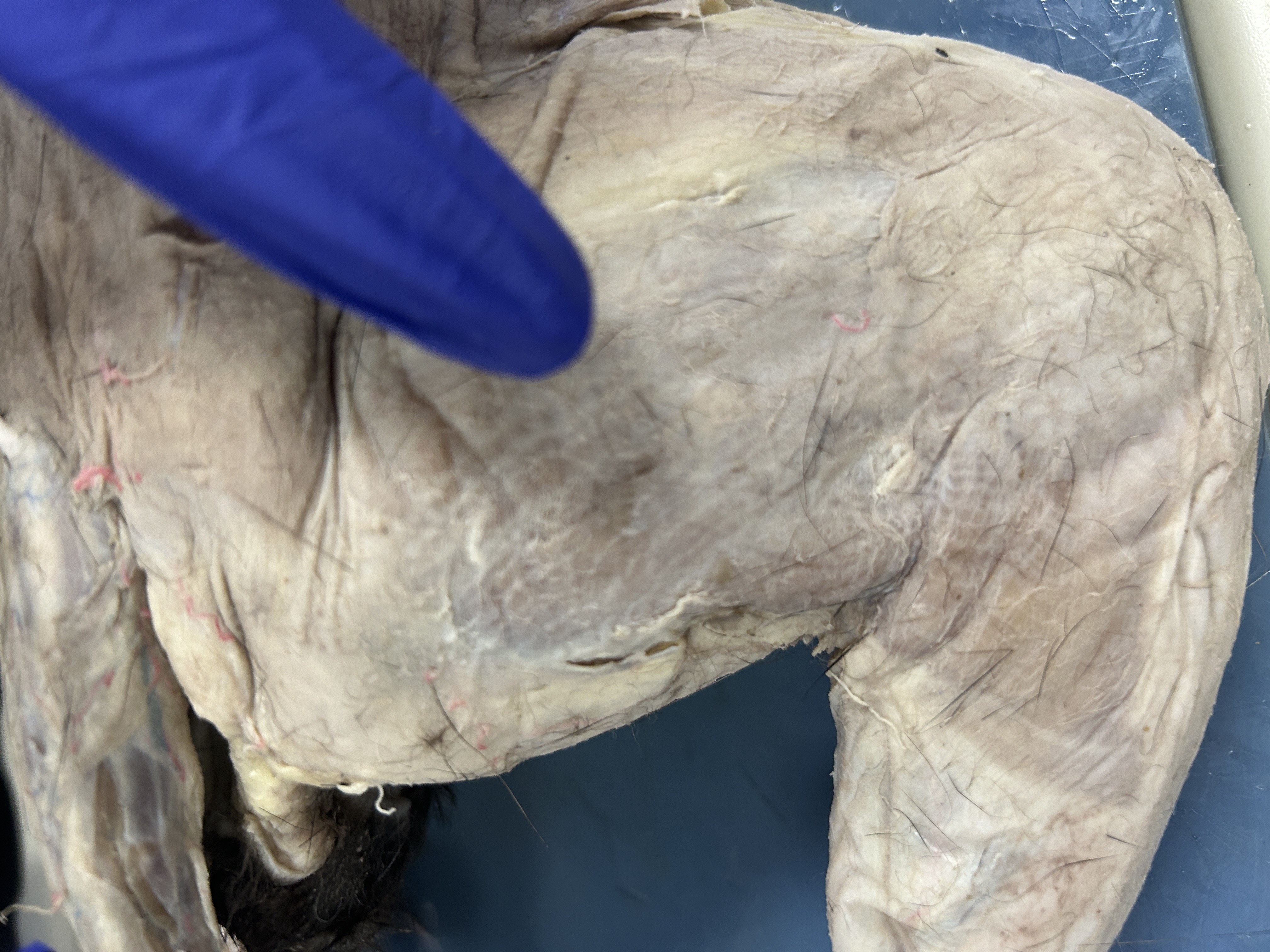 <p>Bicep Femoris (back of theigh)</p>