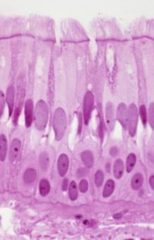 <p>Identify cell type</p>