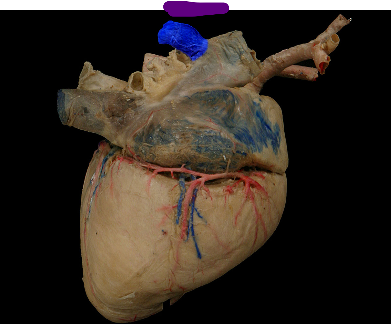 <p>name the structure and tissue type</p>