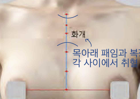 <p>앞정중선 위, 1째 갈비사이공간 높이</p>