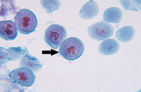 <p>Nuclear membrane breaks down, chromatin condenses, spindle forms and attaches to kinetochores</p>