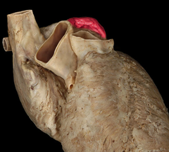 <p>identify the structure</p>