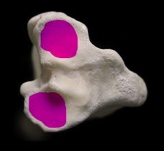 <p>What attaches to these surfaces of the Tibia</p>