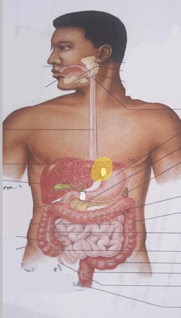 term image