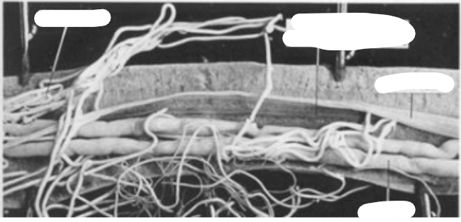 <p>What is this parasite and what are the structures </p>