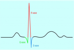 <p>60-100 ms</p>