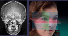 <p>Left vs. right</p>