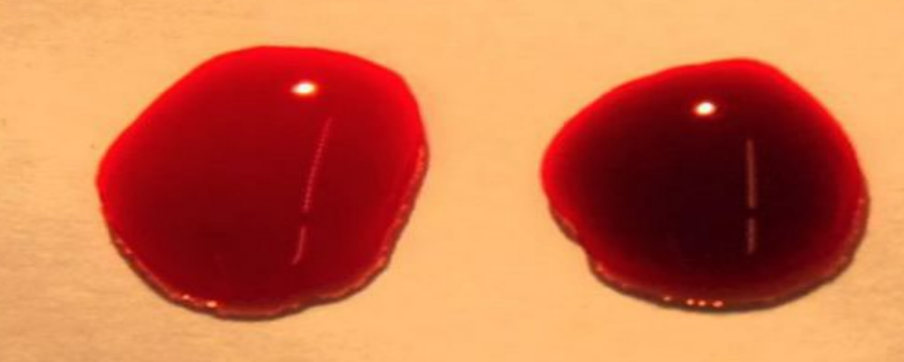 <p>right oxygenated or deoxygenated</p>