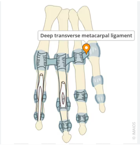 <p>Palmar ligaments of MCP joints II–V. (functions to hold metacarpal heads together)</p>