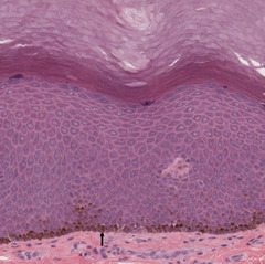 <p>What is the brown staining substance in the skin?</p>