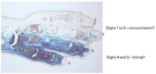 <p><span>unsatisfactory understanding of mouse digit patterning</span></p><p><span>ZPA</span></p>
