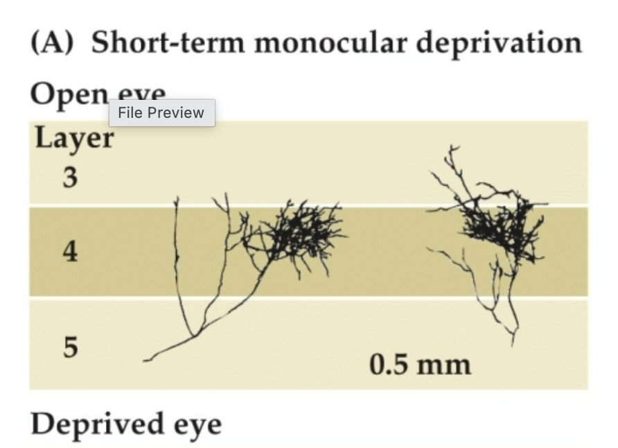 <p>Open Eye</p>