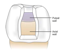 <p>Axial Wall: wall runs parallel to the long axis of the tooth.</p><p>*oriented in the longitudinal plane</p>