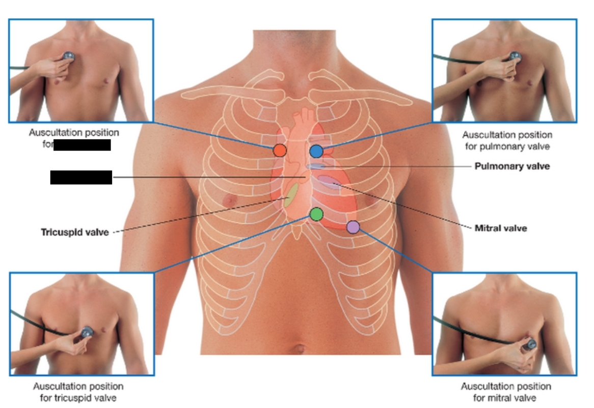 <p>a critical one-way valve in the heart that controls blood flow from the left ventricle into the aorta</p>