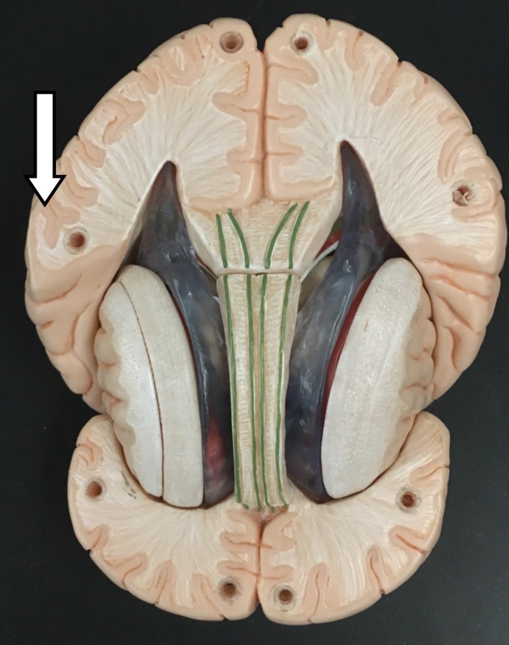 <p>What is the arrow pointing to? (dark outer tissue)</p>