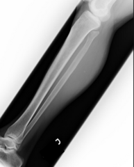 <p>What is the error in this lateral leg X-ray? How should it be corrected?</p>