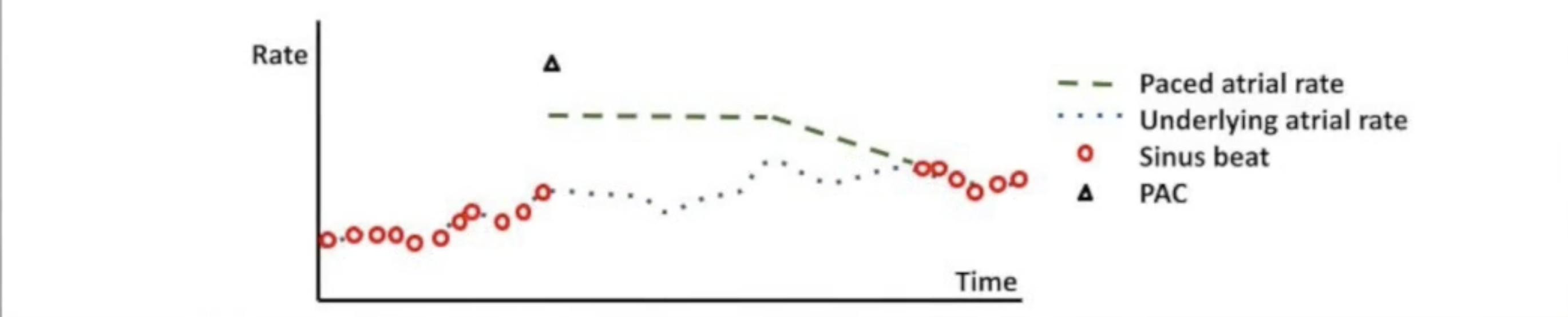 <ul><li><p>PACs can trigger atrial tachyarrhythmias</p></li><li><p>PAC response activated by single rapid beat</p></li><li><p>Triggers atrial pacing at fast rate</p></li><li><p>Gradually decrements to base rate</p></li><li><p>Pace quickly to eliminate pause after PAC and prevent arrhythmias</p></li></ul><p></p>