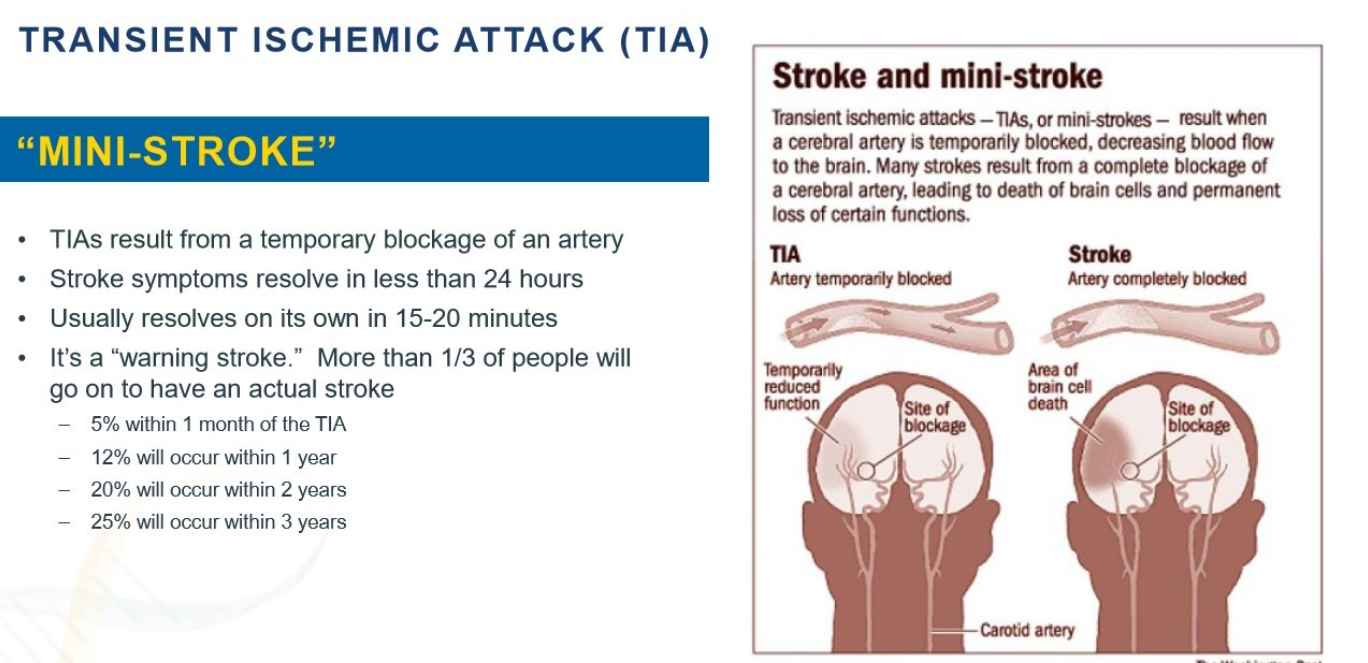 <p>a mini stroke that can resolve on its own</p>