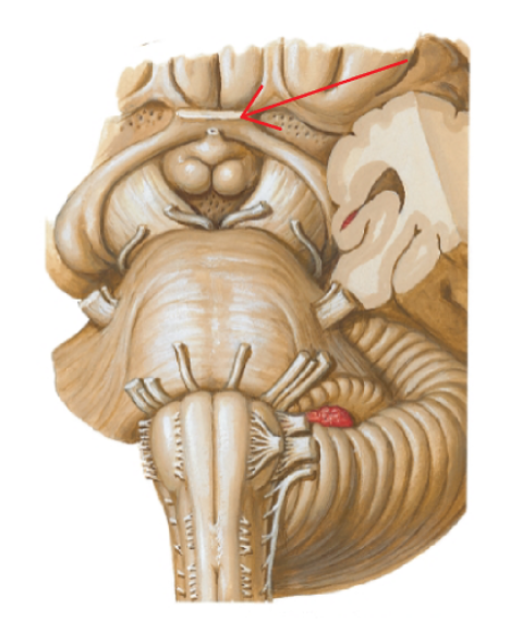 <p>Cranial nerve II</p>