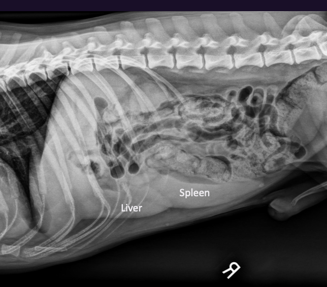 <p>What are the differentials for diffusely enlarged spleen </p>
