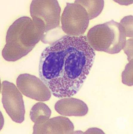 <p>What Leukocyte is this?</p>