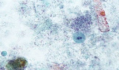 <p><span style="background-color: rgba(0, 0, 0, 0); line-height: 19.7625px;">What is the species in this photo?</span></p>