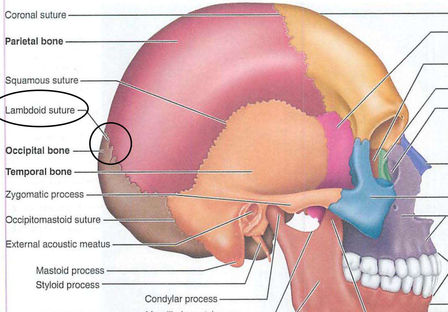 <p>iv. lambdoidal</p>