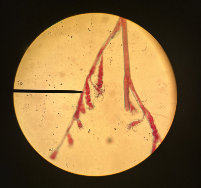 term image