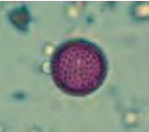 <p>Type of pollen </p>