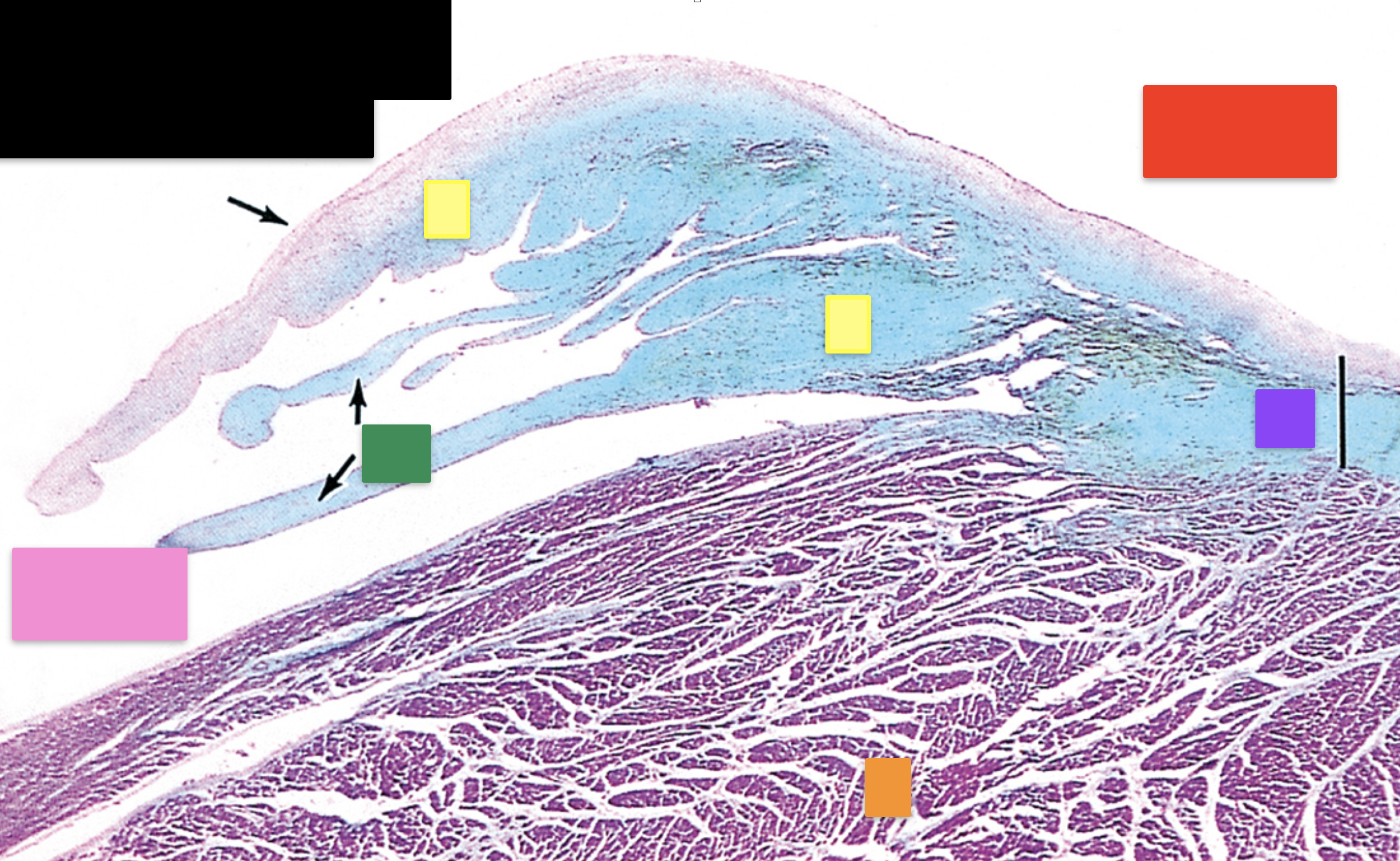 <p>Identify the pink structure</p>