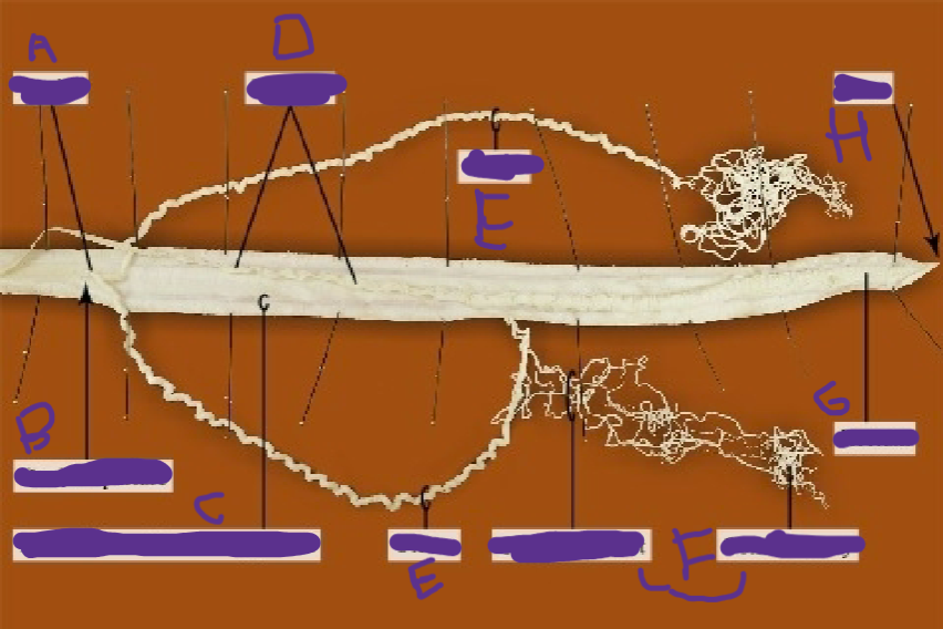 <p>female roundworm (nematoda)</p>